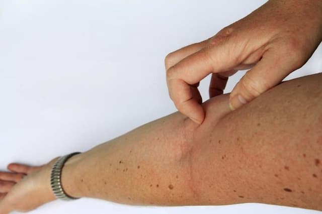 4 Symptome eines Nierenschadens, die leicht zu übersehen sind